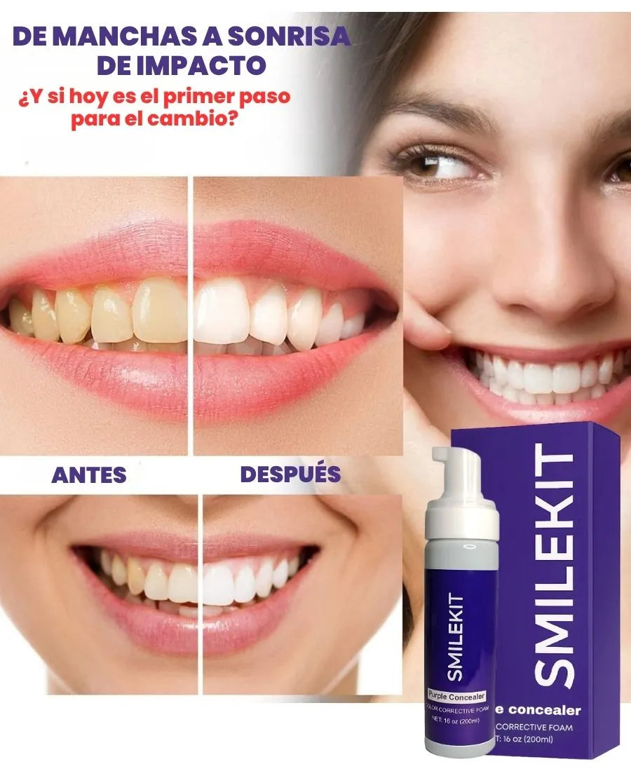 SMILEKIT | Blanquedor dental | Tratamiento efectivo contra las manchas amarilllas de los dientes sin causar sensibilidad