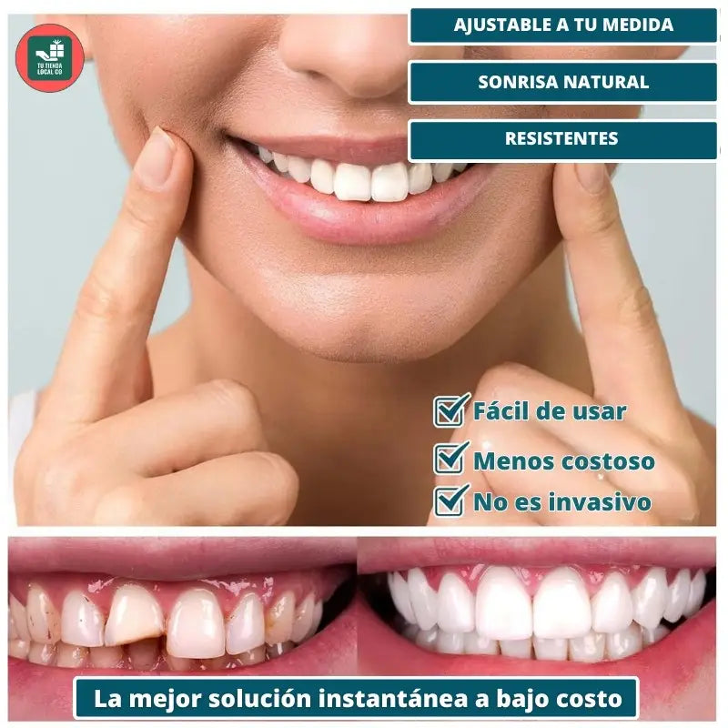 CARILLAS DENTALES SNAP ON DENTURE UN CAMBIO QUE TRANSFORMA TU VIDA AL INSTANTE