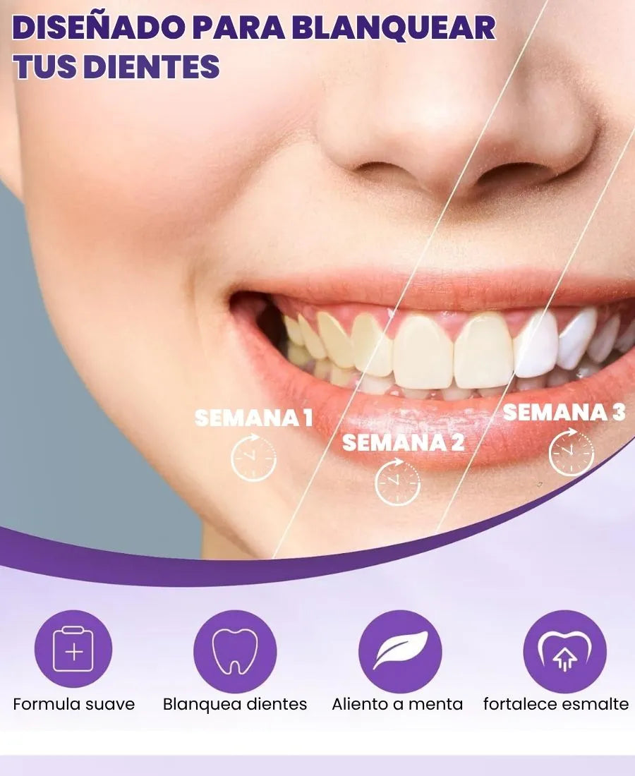 SMILEKIT | Blanquedor dental | Tratamiento efectivo contra las manchas amarilllas de los dientes sin causar sensibilidad